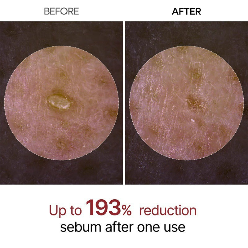 Silken™ Peel Shot Rice Ampoule
