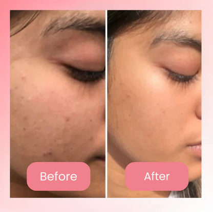 Rejuvé™ Collagen Wrap