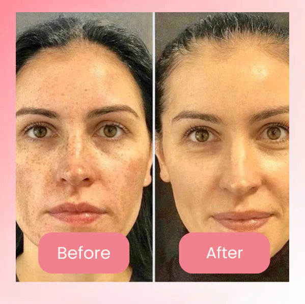 Rejuvé™ Collagen Wrap