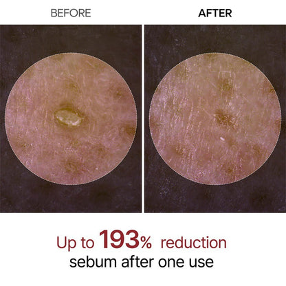 Silken™ Peel Shot Rice Ampoule